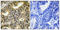 Eukaryotic Translation Initiation Factor 4E Binding Protein 1 antibody, A00968T70, Boster Biological Technology, Immunohistochemistry paraffin image 