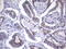 Alpha-Methylacyl-CoA Racemase antibody, LS-C797873, Lifespan Biosciences, Immunohistochemistry paraffin image 