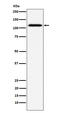 TNF Receptor Superfamily Member 8 antibody, M01225-2, Boster Biological Technology, Western Blot image 