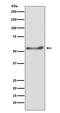 ATP Synthase F1 Subunit Alpha antibody, M03598, Boster Biological Technology, Western Blot image 
