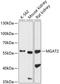 Mannosyl (Alpha-1,6-)-Glycoprotein Beta-1,2-N-Acetylglucosaminyltransferase antibody, A06432, Boster Biological Technology, Western Blot image 