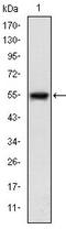 Mitogen-Activated Protein Kinase Kinase Kinase 5 antibody, AM06637SU-N, Origene, Western Blot image 