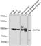 Inositol Polyphosphate-4-Phosphatase Type I A antibody, 23-111, ProSci, Western Blot image 