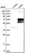 Interleukin 3 Receptor Subunit Alpha antibody, NBP1-86549, Novus Biologicals, Western Blot image 