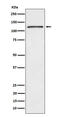 FYN Binding Protein 1 antibody, M32410-1, Boster Biological Technology, Western Blot image 