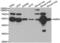 Matrix Metallopeptidase 8 antibody, abx002192, Abbexa, Western Blot image 