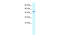 Elongin C antibody, 31-241, ProSci, Enzyme Linked Immunosorbent Assay image 