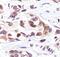 p53 antibody, PA5-17596, Invitrogen Antibodies, Immunohistochemistry paraffin image 