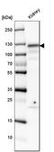 Angiotensin I Converting Enzyme 2 antibody, HPA000288, Atlas Antibodies, Western Blot image 