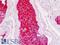 Alpha-1-antitrypsin antibody, LS-B9010, Lifespan Biosciences, Immunohistochemistry paraffin image 