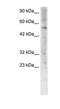 Zinc Finger Protein 500 antibody, PA1-24397, Invitrogen Antibodies, Western Blot image 