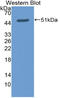 TNF Superfamily Member 8 antibody, LS-C314396, Lifespan Biosciences, Western Blot image 