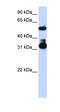 F-Box And WD Repeat Domain Containing 2 antibody, orb330283, Biorbyt, Western Blot image 