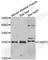 Cysteine And Glycine Rich Protein 3 antibody, A6569, ABclonal Technology, Western Blot image 