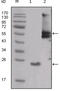 SRC Proto-Oncogene, Non-Receptor Tyrosine Kinase antibody, abx012187, Abbexa, Enzyme Linked Immunosorbent Assay image 