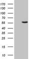Casein Kinase 1 Gamma 1 antibody, TA806333S, Origene, Western Blot image 