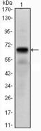 Parathyroid Hormone 1 Receptor antibody, GTX82794, GeneTex, Western Blot image 