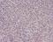 PMS1 Homolog 2, Mismatch Repair System Component antibody, M01028-1, Boster Biological Technology, Immunohistochemistry paraffin image 