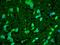 Heat Shock Protein Family B (Small) Member 8 antibody, LS-C109063, Lifespan Biosciences, Immunofluorescence image 