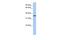 UDP-Galactose-4-Epimerase antibody, PA5-44158, Invitrogen Antibodies, Western Blot image 