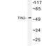 TERF1 Interacting Nuclear Factor 2 antibody, LS-C176832, Lifespan Biosciences, Western Blot image 