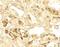 Calcium Sensing Receptor antibody, NBP2-41271, Novus Biologicals, Immunohistochemistry paraffin image 