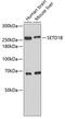 SET Domain Containing 1B, Histone Lysine Methyltransferase antibody, 18-602, ProSci, Western Blot image 