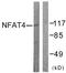 Nuclear Factor Of Activated T Cells 3 antibody, LS-C117674, Lifespan Biosciences, Western Blot image 