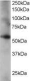 Coronin 1C antibody, MBS421311, MyBioSource, Western Blot image 