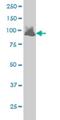 Vav Guanine Nucleotide Exchange Factor 1 antibody, H00007409-M01, Novus Biologicals, Western Blot image 