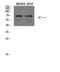 Protein Phosphatase 1 Regulatory Subunit 15A antibody, A02394, Boster Biological Technology, Western Blot image 