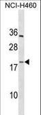 Platelet factor 4 variant antibody, LS-C158574, Lifespan Biosciences, Western Blot image 