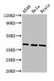 HLA class I histocompatibility antigen, Cw-7 alpha chain antibody, CSB-PA320739LA01HU, Cusabio, Western Blot image 