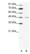 Cholinergic Receptor Nicotinic Delta Subunit antibody, PA1-24271, Invitrogen Antibodies, Western Blot image 