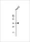 FosB Proto-Oncogene, AP-1 Transcription Factor Subunit antibody, 62-552, ProSci, Western Blot image 