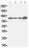 Integrin Subunit Beta 3 antibody, PA1627, Boster Biological Technology, Western Blot image 