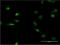 Lamin B1 antibody, H00004001-M03, Novus Biologicals, Immunocytochemistry image 