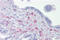 Inhibitor Of Growth Family Member 3 antibody, 25-133, ProSci, Immunohistochemistry frozen image 