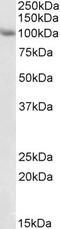 Tripartite Motif Containing 71 antibody, EB09901, Everest Biotech, Western Blot image 