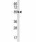 Cyclin A1 antibody, F47273-0.4ML, NSJ Bioreagents, Western Blot image 