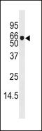 Adenosine Kinase antibody, 62-654, ProSci, Western Blot image 