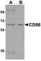 CD86 antibody, A00220, Boster Biological Technology, Western Blot image 