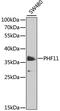 PHD Finger Protein 11 antibody, 14-982, ProSci, Western Blot image 