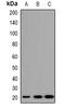 Trafficking Protein Particle Complex 5 antibody, orb382485, Biorbyt, Western Blot image 