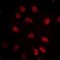 Heat Shock Transcription Factor 1 antibody, orb256608, Biorbyt, Immunofluorescence image 