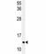 Microtubule Associated Protein 1 Light Chain 3 Gamma antibody, F46129-0.4ML, NSJ Bioreagents, Western Blot image 