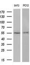 AKT Serine/Threonine Kinase 3 antibody, M00520-1, Boster Biological Technology, Western Blot image 