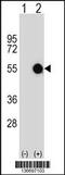 Makorin Ring Finger Protein 2 antibody, 59-011, ProSci, Western Blot image 