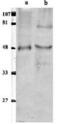 Tyrosyl-DNA Phosphodiesterase 2 antibody, PA1-46295, Invitrogen Antibodies, Western Blot image 