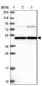 Transmembrane Protein 266 antibody, NBP1-81939, Novus Biologicals, Western Blot image 